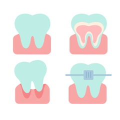 Vector flat illustration of teeth in different states.