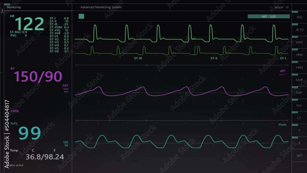Poster vital signs monitor with heart rate and other medical parameters on an animated mock-up. patient's v
