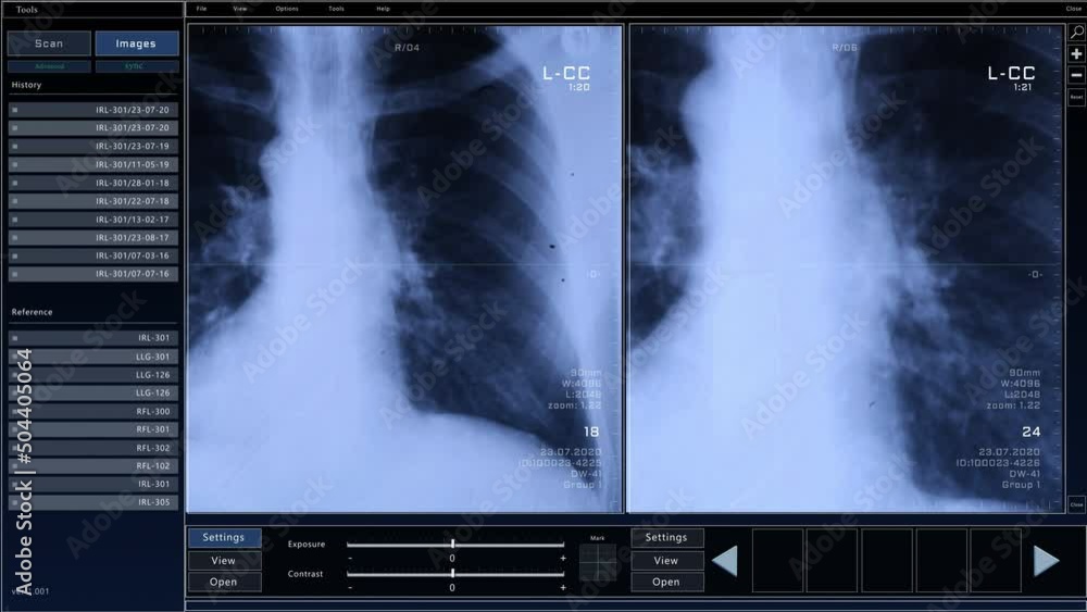 Aufkleber Computed Tomography Chest Scan Mock-up with Multiple Windows and Data. Medical Research Environment Software with CT Scan Results for Computer Displays and Laptop Screens.