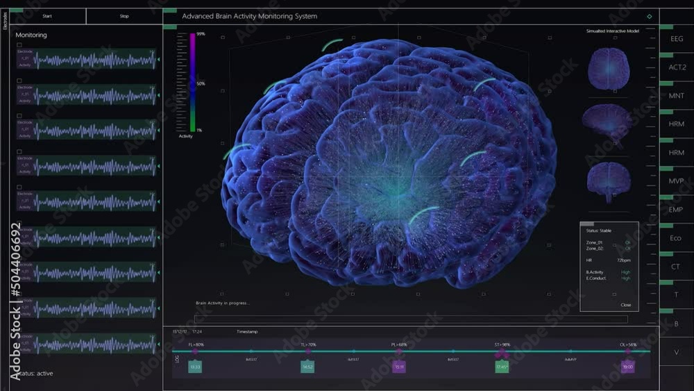 Aufkleber Brain Activity Monitoring System Mock-up with Multiple Windows and Data. Medical Research Environment Software with MRI Scan Results for Computer Displays and Laptop Screens.