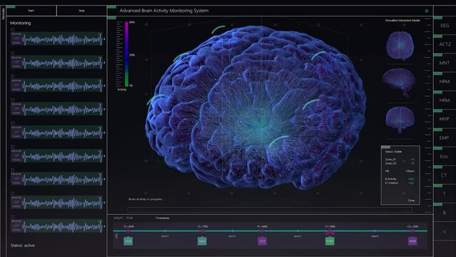 Brain Activity Monitoring System Mock-up with Multiple Windows and Data. Medical Research Environment Software with MRI Scan Results for Computer Displays and Laptop Screens.
