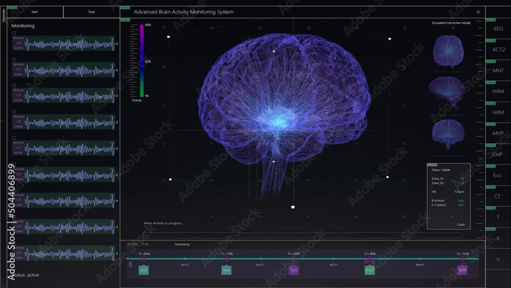 Aufkleber Brain Activity Monitoring System Mock-up with Multiple Windows and Data. Medical Research Environment Software with MRI Scan Results for Computer Displays and Laptop Screens.