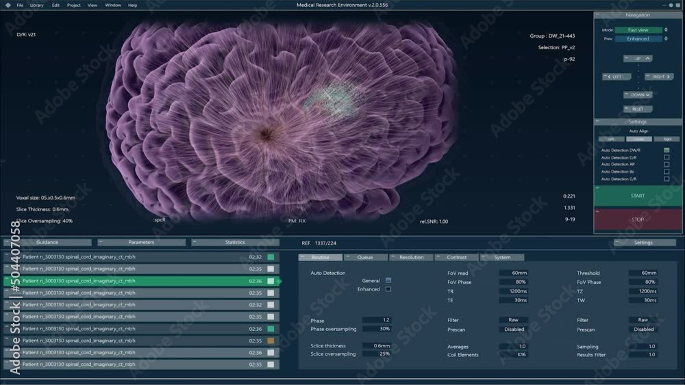 Poster Brain Activity Monitoring System Mock-up with Multiple Windows and Data. Medical Research Environment Software with MRI Scan Results for Computer Displays and Laptop Screens.