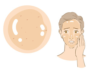 テカリ、脂性肌に悩む爽やかな男性