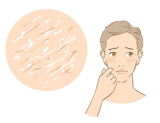 乾燥肌に悩む爽やかな男性