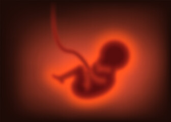 Pregnancy concept. Blurred Child in the womb, embryo. Vector illustration.