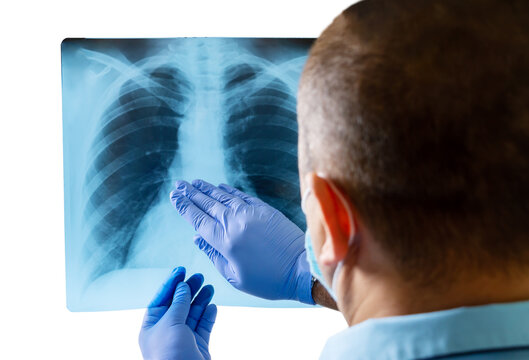 Male doctor in lab coat, medical gloves and mask reading and analysing issue in lungs of patient with x-ray film. Isolated mockup on white background, closeup. Selective focus
