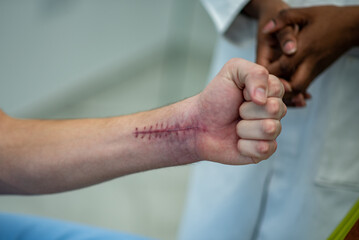 Scars on the skin of the man arm after surgery