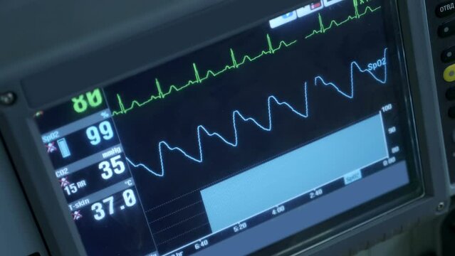 Heart rate monitor screen with live graph and numeric data of heart work. Close up