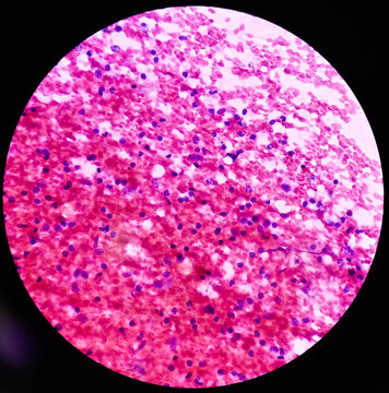Histoplasma Images – Browse 58 Stock Photos, Vectors, and Video | Adobe ...