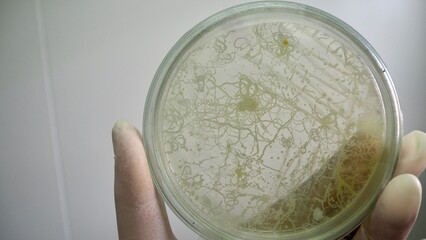 Microbial bacteria on  media plate