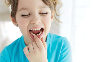 The kid lost a tooth. Baby without a tooth. Portrait of a little girl no tooth. High quality photo