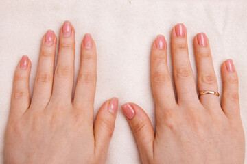 girl's nails with regrown gel coating, untidy and well-groomed hand with fresh manicure gentle nude coating.