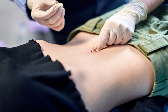 Crop piercer inserting piercing into belly button