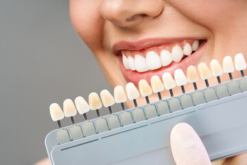 Smiling young woman. Cosmetological teeth whitening in a dental clinic. selection of the tone of the implant tooth