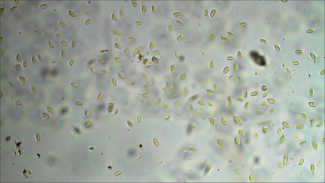 Micro organisms ciliates moving