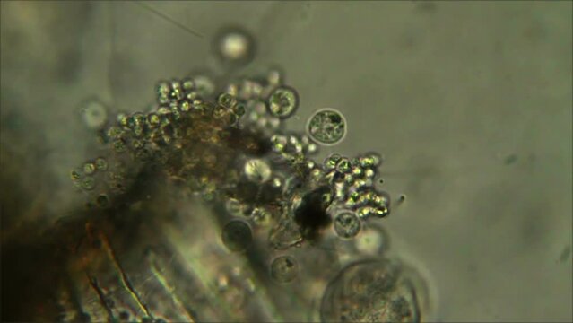 Micro organisms - colony of ciliates