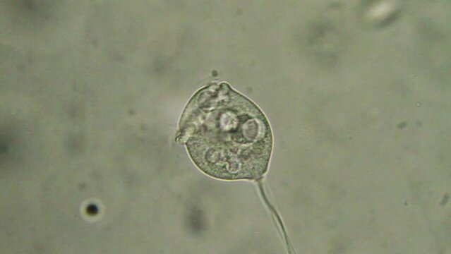 Micro organism vorticella