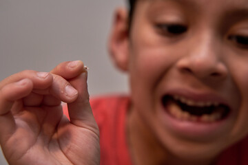 A little latino boy holds a tooth in his hand and open his mouth ans shows the empty space in his denture. Baby teeth fall out. Selective focus