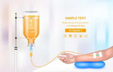 Fotobehang Vitamin iv drip treatment. Needle Intravenous for infusion on arm in clinic with warm tone. Vitamin C serum collagen orange inside saline bottle. Medical and beauty concept. Vector EPS 10. © Adisak