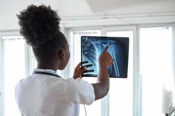 Woman doctor in hospital looking at x-ray film healthcare, roentgen, people and medicine concept. Young smiling female doctor with stethoscope pointing at X-ray at doctor's office