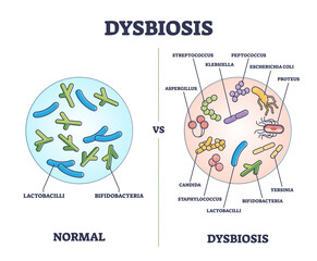 Dysbiosis versus normal gut or tract microflora with bacteria outline diagram. Labeled educational scheme with digestive system differences vector illustration. Microscopic microbe flora comparison.