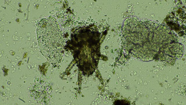 microorganisms and soil biology, with nematodes and fungi under the microscope. in a soil and compost 