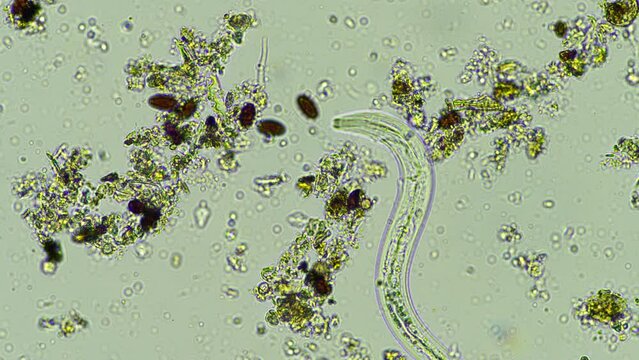 nematode in compost, in soil under the microscope	