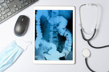 X-ray image of the gastrointestinal tract in a tablet. The concept of telemedicine and diagnosis of...