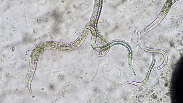nematode in compost, in soil under the microscope	