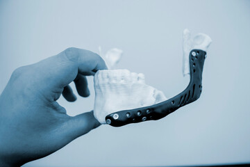 Person holds in hand an example of artificial jaw printed on 3D printer with endoprosthesis made of...