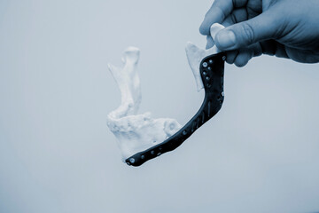 Person holding in hand facial mandibular endoprosthese printed on metal 3D printer from bionert titanium alloy close-up. 3D model bionic implants for maxillofacial Surgery. Lower jaw facial prostheses
