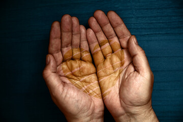 The golden heart. A heart shape painted with golden paint and split over both hands. Volunteer,...