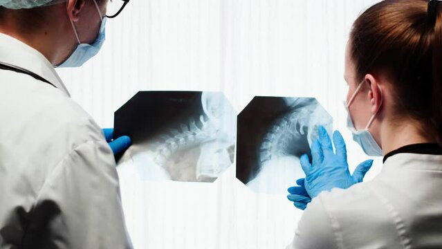 Doctors examining neck x-ray close-up. Magnetic Resonance Image of Spinal Column, Skull Head. Man and woman therapist looking at xray of spine bones. Healthcare and medicine concept.