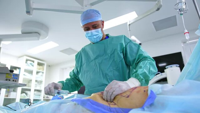 Surgeon performs abdominal liposuction in modern hospital. Doctor thrusting huge syringe with medicines into patient's abdomen. Low angle view.