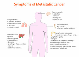 symptoms of metastatic cancer, vector, medical