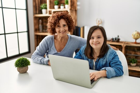 Mature mother and down syndrome daughter using computer laptop at home