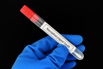 Nasopharyngeal swab from patient for COVID-19 test by using RT-PCR method 