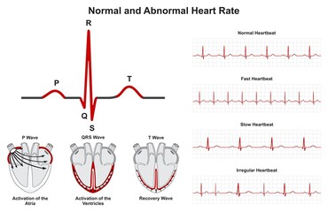 Normal and abnormal human heart beat rate infographic diagram for cardiology medical science education fast slow irregular heartbeat heartrate waves ecg sinus rhythm vector chart illustration
