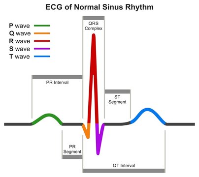 ECG Of Normal Sinus Rhythm Infographic Diagram Heartrate Chart Heartbeat Graph Scheme For Cardiology Medical Science Education Wave Interval Segment Heart Beat Rate Pulse Vector Illustration