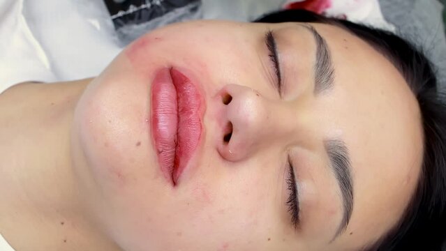 the permanent makeup artist erases excess red pigments from the model's lip