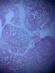 Lung tissue histology isolated