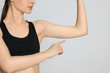 Slim young woman with marks on arm against light background, closeup. Weight loss surgery