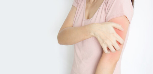 woman are itching and scratching of skin diseases. Concept with Healthcare And Medicine.