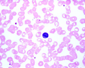 Human blood smear. Lymphocyte