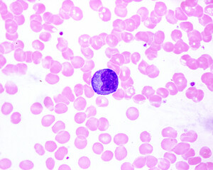 Human blood smear. Monocyte