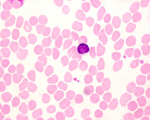 Fototapeta na wymiar Human blood smear. Lymphocyte