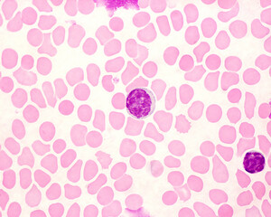 Human blood smear. Monocyte and lymphocyte
