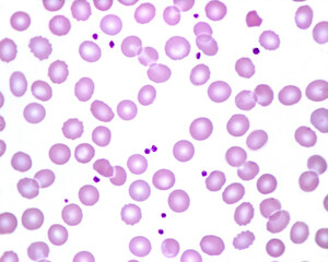 Human blood smear. Platelets