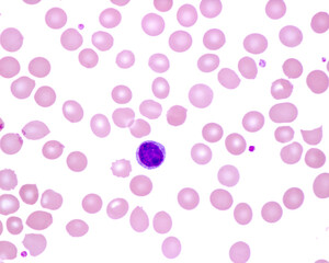 Human blood smear. Lymphocyte